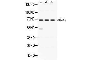Western blot analysis of ABCE1 expression in rat spleen extract ( Lane 1), mouse thymus extract ( Lane 2) and HELA whole cell lysates ( Lane 3).