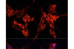 Immunofluorescence analysis of NIH-3T3 cells using ETF1 Polyclonal Antibody at dilution of 1:100 (40x lens).