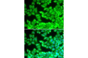 Immunofluorescence analysis of U20S cell using CD40LG antibody. (CD40 Ligand Antikörper  (AA 47-223))