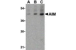 Western Blotting (WB) image for anti-CD5 Molecule-Like (CD5L) (N-Term) antibody (ABIN2472166) (CD5L Antikörper  (N-Term))