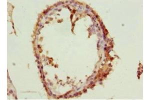 Immunohistochemistry of paraffin-embedded human testis tissue using ABIN7170599 at dilution of 1:100 (Spindlin 1 Antikörper  (AA 1-262))