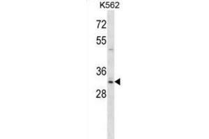 Western Blotting (WB) image for anti-Homeobox B8 (HOXB8) antibody (ABIN2998503) (HOXB8 Antikörper)