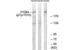 Western blot analysis of extracts from HepG2 cells treated with Na2VO3 0.