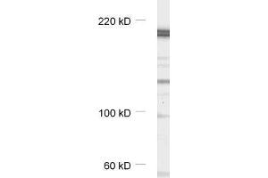 dilution: 1 : 1000, sample: synaptic membrane fraction of rat brain (LP1) (CASKIN1 Antikörper)