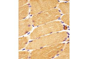Antibody staining DVL1 in human skeletal muscle sections by Immunohistochemistry (IHC-P - paraformaldehyde-fixed, paraffin-embedded sections). (DVL1 Antikörper  (AA 442-470))