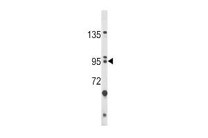 Western blot analysis of BICC1 Antibody (N-term) (ABIN390954 and ABIN2841144) in HL-60 cell line lysates (35 μg/lane). (BICC1 Antikörper  (N-Term))