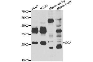 Western blot analysis of extracts of various cell lines, using GCA antibody. (Grancalcin Antikörper)