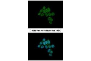 ICC/IF Image Immunofluorescence analysis of paraformaldehyde-fixed HCT116, using CREB3L1, antibody at 1:500 dilution. (CREB3L1 Antikörper  (C-Term))