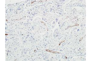Immunohistochemistry (IHC) image for anti-Cadherin 5 (CDH5) (AA 48-599) antibody (ABIN7455190) (Rekombinanter Cadherin 5 Antikörper  (AA 48-599))