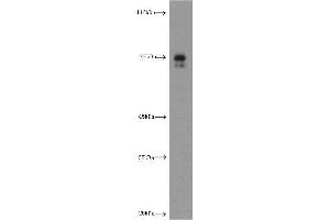 Western Blotting (WB) image for anti-Hepatic and Glial Cell Adhesion Molecule (HEPACAM) antibody (ABIN2932707) (HEPACAM Antikörper)