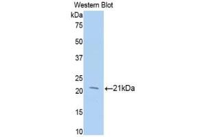 Western blot analysis of the recombinant protein. (MGEA5 Antikörper  (AA 271-438))