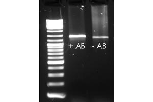 EndpointPCR with and without HotStart Antibody (Taq DNA Polymerase Antikörper)