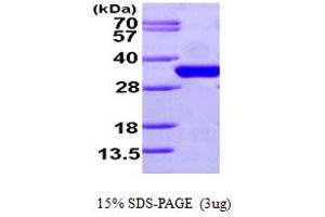 SDS-PAGE (SDS) image for Cell Division Cycle 34 (CDC34) (AA 1-236) protein (His tag) (ABIN667208) (CDC34 Protein (AA 1-236) (His tag))