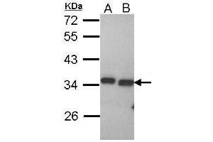 WB Image Sample (30 ug of whole cell lysate) A: Hela B: Hep G2 , 12% SDS PAGE antibody diluted at 1:1000 (PECR Antikörper  (C-Term))