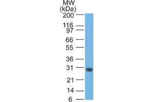 Western Blot Analysis of Jurkat cell lysate Bcl-x Mouse Monoclonal Antibody (2H12). (BCL2L1 Antikörper  (AA 3-14))