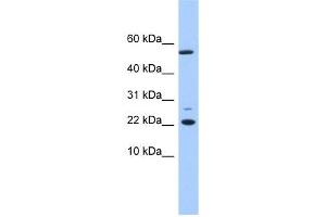 DPH4 antibody used at 1 ug/ml to detect target protein. (DNAJC24 Antikörper  (N-Term))