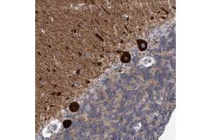 Immunohistochemical staining of human cerebellum with KCTD8 polyclonal antibody  shows strong cytoplasmic positivity in Purkinje cells at 1:20-1:50 dilution. (KCTD8 Antikörper)