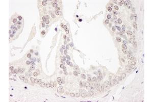 anti-Cyclin L1 (CCNL1) (AA 300-350) antibody