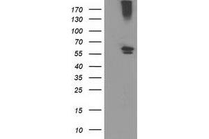 Western Blotting (WB) image for anti-Cytochrome P450, Family 2, Subfamily J, Polypeptide 2 (CYP2J2) antibody (ABIN1497731) (CYP2J2 Antikörper)
