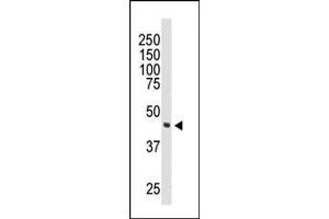 Western blot analysis of anti-DOK2 Pab (ABIN392072 and ABIN2841834) in 174xCEM cell lysate. (DOK2 Antikörper  (C-Term))