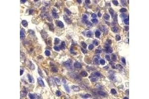 Immunohistochemistry of Bonzo in human spleen cells with Bonzo antibody at 20 μg/ml. (CXCR6 Antikörper  (N-Term))