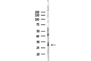 anti-SRY (Sex Determining Region Y)-Box 21 (SOX21) (C-Term) antibody