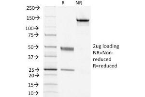 SDS-PAGE Analysis Purified TSHRB Monoclonal Antibody (TSHRB/1405). (TSH receptor Antikörper)