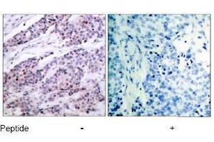 Image no. 1 for anti-B-Cell CLL/lymphoma 2 (BCL2) (AA 54-58) antibody (ABIN197202) (Bcl-2 Antikörper  (AA 54-58))