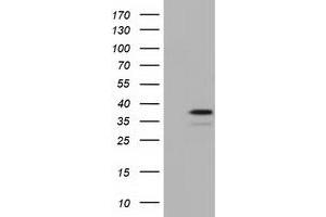 Western Blotting (WB) image for anti-E3 SUMO-Protein Ligase NSE2 (NSMCE2) antibody (ABIN1499526) (NSMCE2 Antikörper)
