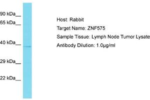 Host: Rabbit Target Name: ZNF575 Sample Tissue: Human Lymph Node Tumor Antibody Dilution: 1ug/ml (ZNF575 Antikörper  (Middle Region))