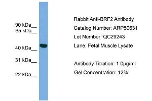 WB Suggested Anti-BRF2  Antibody Titration: 0. (BRF2 Antikörper  (Middle Region))