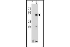 Western blot analysis of RBM22 (arrow) usingRBM22 Antibody . (RBM22 Antikörper  (Middle Region))