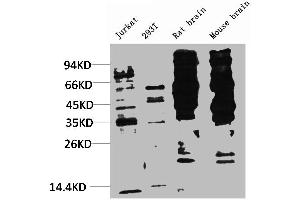 Western blot analysis of 1) Jurkat, 2) 293T, 3) Rat Brain Tissue, 4) Mouse Brain Tissue with Phosphotyrosine Mouse mAb diluted at 1:2,000. (Phosphotyrosine Antikörper)