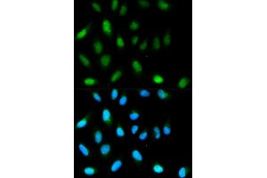 Immunofluorescence analysis of HeLa cells using CBX5 antibody. (CBX5 Antikörper)