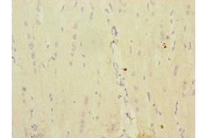 Immunohistochemistry of paraffin-embedded human heart tissue using ABIN7142250 at dilution of 1:100 (MRPS16 Antikörper  (AA 1-137))