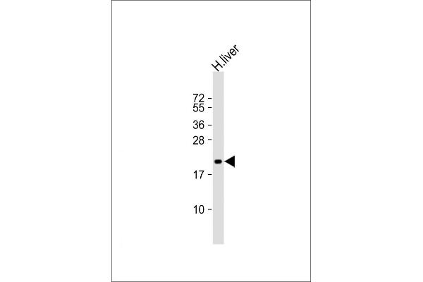 ROPN1 Antikörper  (AA 91-121)
