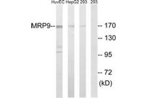 Western Blotting (WB) image for anti-ATP-Binding Cassette, Sub-Family C (CFTR/MRP), Member 12 (ABCC12) (AA 691-740) antibody (ABIN2890422) (ABCC12 Antikörper  (AA 691-740))