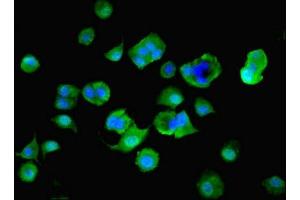 Immunofluorescent analysis of MCF-7 cells using ABIN7142610 at dilution of 1:100 and Alexa Fluor 488-congugated AffiniPure Goat Anti-Rabbit IgG(H+L) (MTHFS Antikörper  (AA 2-203))