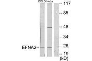 Western blot analysis of extracts from HeLa/COLO205 cells, using EFNA2 Antibody. (Ephrin A2 Antikörper  (AA 1-50))