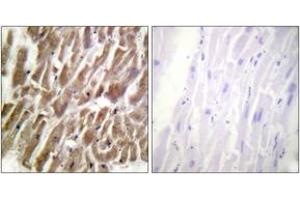 Immunohistochemistry (IHC) image for anti-Cardiac Troponin I (TNNI3) (AA 11-60) antibody (ABIN2888778) (TNNI3 Antikörper  (AA 11-60))