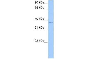 Western Blot showing hCG_1982709 antibody used at a concentration of 1-2 ug/ml to detect its target protein. (hCG_1982709 (N-Term) Antikörper)