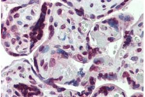 Human Placenta: Formalin-Fixed, Paraffin-Embedded (FFPE) (SHROOM2 Antikörper  (AA 1554-1616))