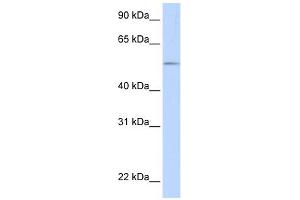UGT1A1 antibody used at 1 ug/ml to detect target protein.