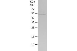 Glutathione Reductase Protein (GSR) (AA 273-522) (His-IF2DI Tag)