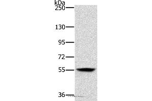 Western blot analysis of Mouse skin tissue, using LOXL1 Polyclonal Antibody at dilution of 1:200