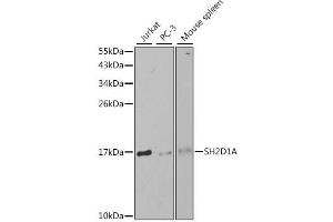 Western blot analysis of extracts of various cell lines, using SH2D1A antibody. (SH2D1A Antikörper)