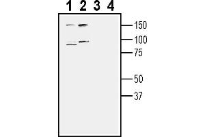 Western blot analysis of human Malme-3M melanoma cell line lysate (lanes 1 and 3) and human PANC1 pancreatic duct carcinoma cell line lysate (lanes 2 and 4):1-2.
