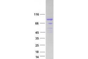 Validation with Western Blot (GRK2 Protein (Myc-DYKDDDDK Tag))