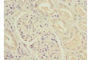 Immunohistochemistry (IHC) image for anti-NADH Dehydrogenase (Ubiquinone) Fe-S Protein 3, 30kDa (NADH-Coenzyme Q Reductase) (NDUFS3) (AA 37-264) antibody (ABIN7160958)