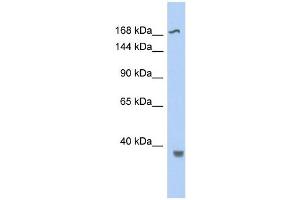 WB Suggested Anti-TOP2B Antibody Titration:  0. (TOP2B Antikörper  (Middle Region))